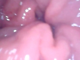 anal